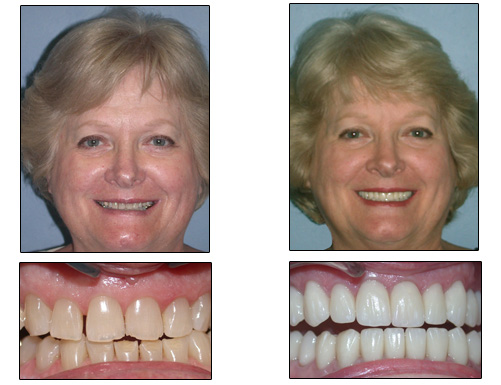 Bioesthetic Dental Rejuvenation